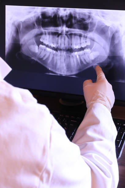 Best Emergency Dental Care for Broken or Chipped Teeth in Han, GA