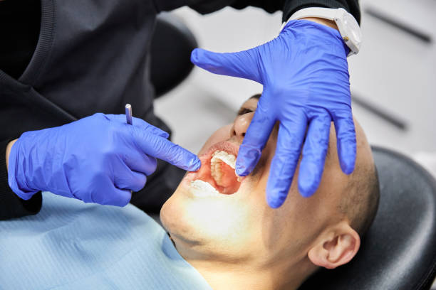 Best Emergency Gum Treatment in Han, GA
